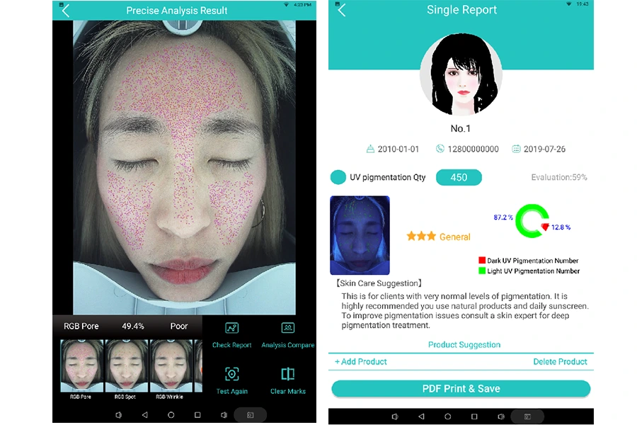 skin analysis Krysmed