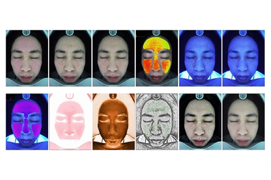 skin analysis Krysmed