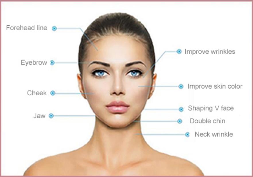 Dermalift 7D HIFU Applications Face Dermalift 7D HIFU Applications Face