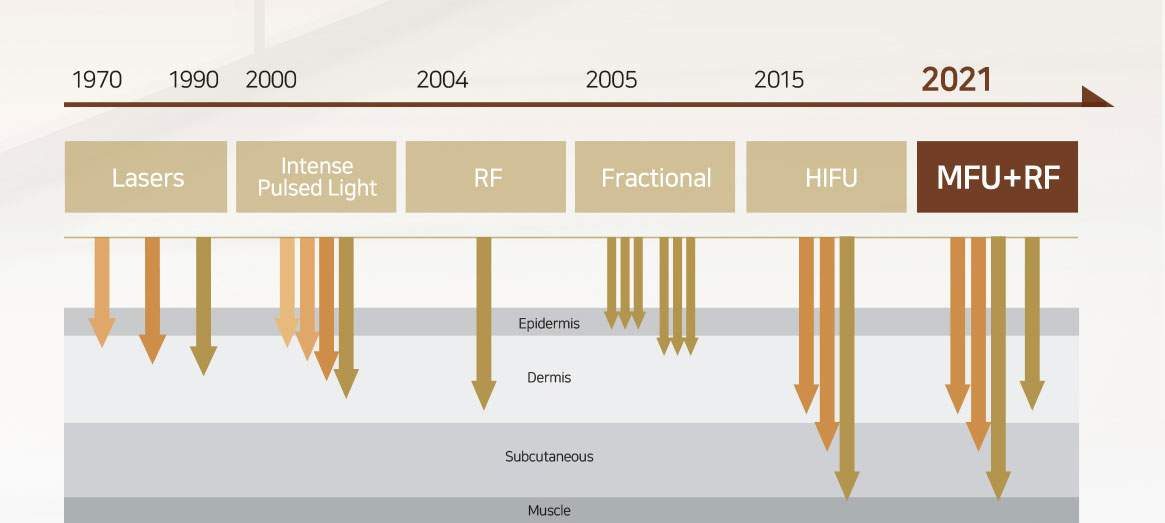 DermaLift SD HIFU working principle