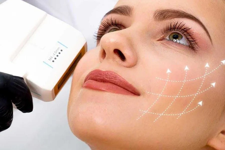 Skin Tightening  Rejuvenation