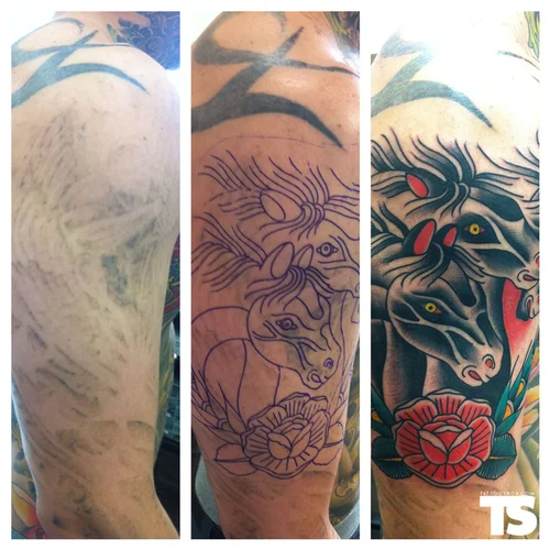 tattoo removal treatment LaserTone Pico Mini