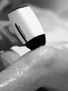 KrySmooth AI Diode Laser Krysmed 2