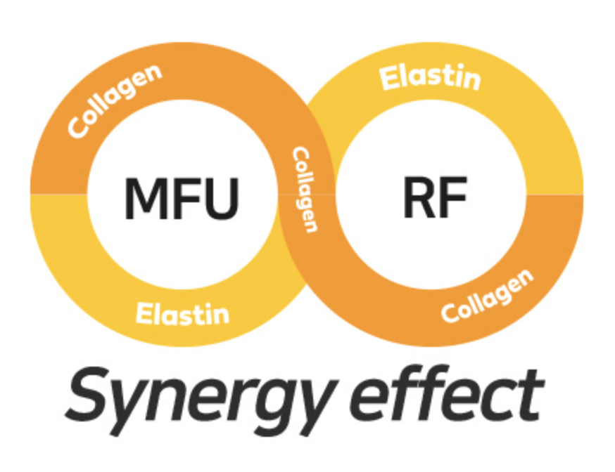 DermaLift SD HIFU Synergy Effect