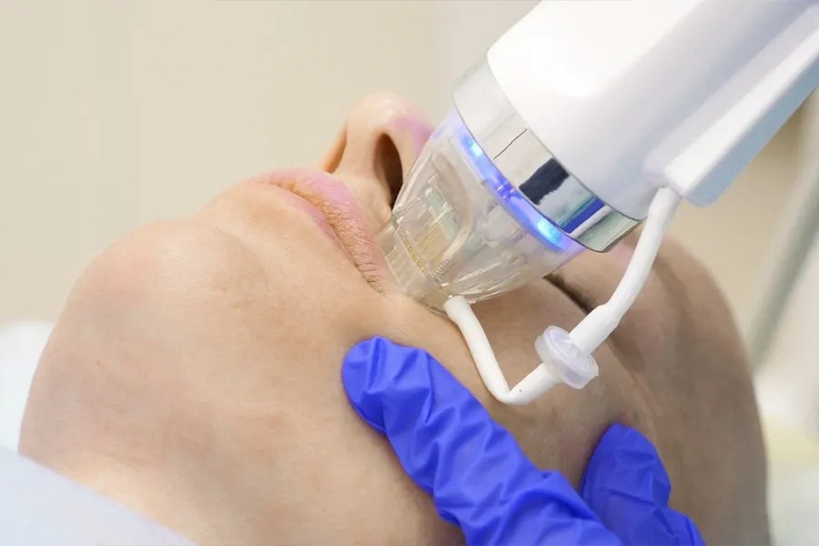 Scarring and Stretch Marks Treatment