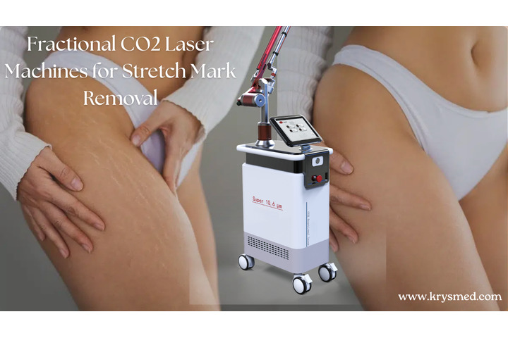 Fractional CO2 Laser Machines for Stretch Mark Removal: How They Work, Key Benefits, and Cost Guide