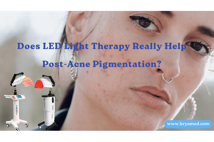 Does LED Light Therapy Really Help Post-Acne Pigmentation? What Clinics Should Know