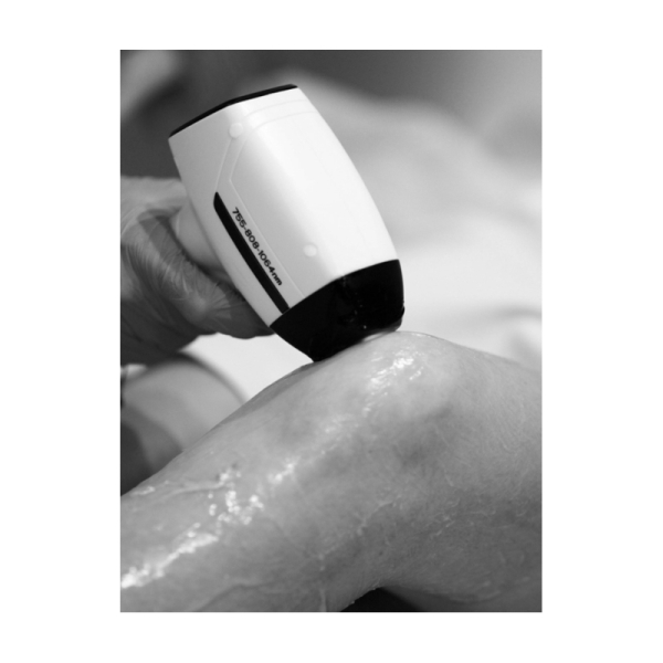 KrySmooth AI Diode Laser