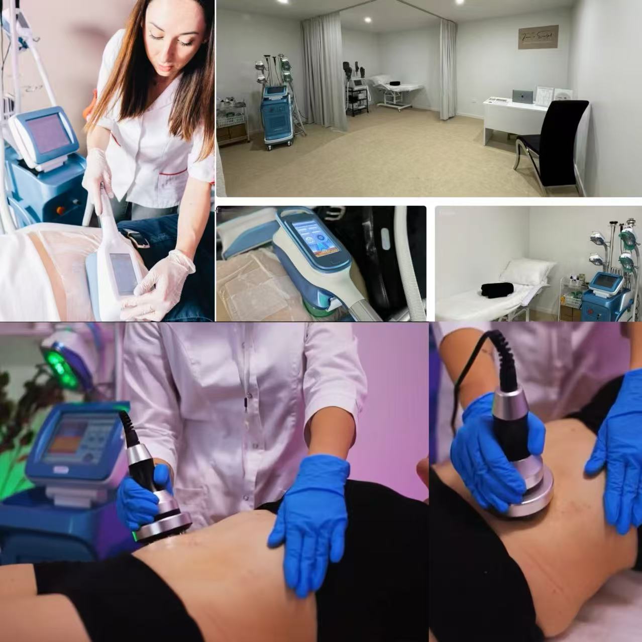 CryoSculpt Pro 360 feedback CryoSculpt Pro 360 feedback