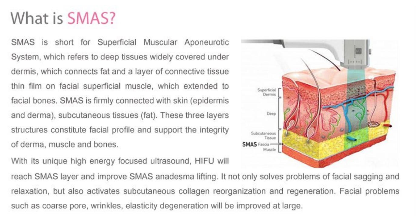 What is HIFU SMAS layer