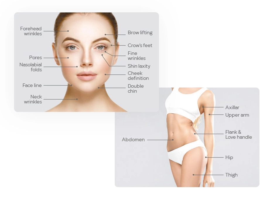 Face and Body areas of HIFU