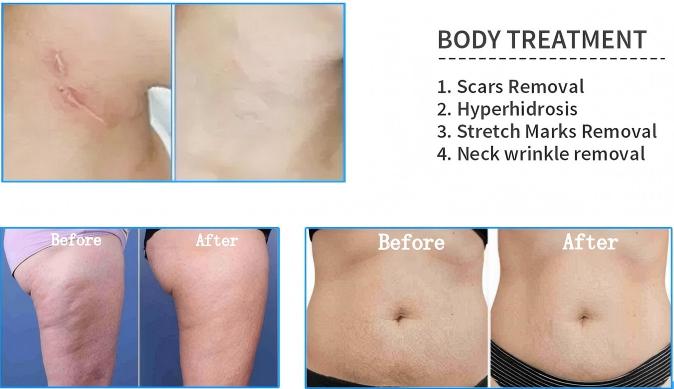 Before-and-After-of-Before and After of DermaVance Gold