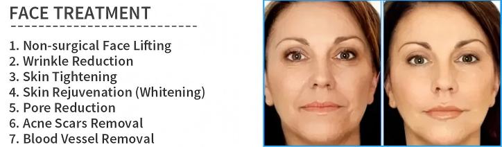 Before-and-After-of-dBefore and After of DermaVance Gold