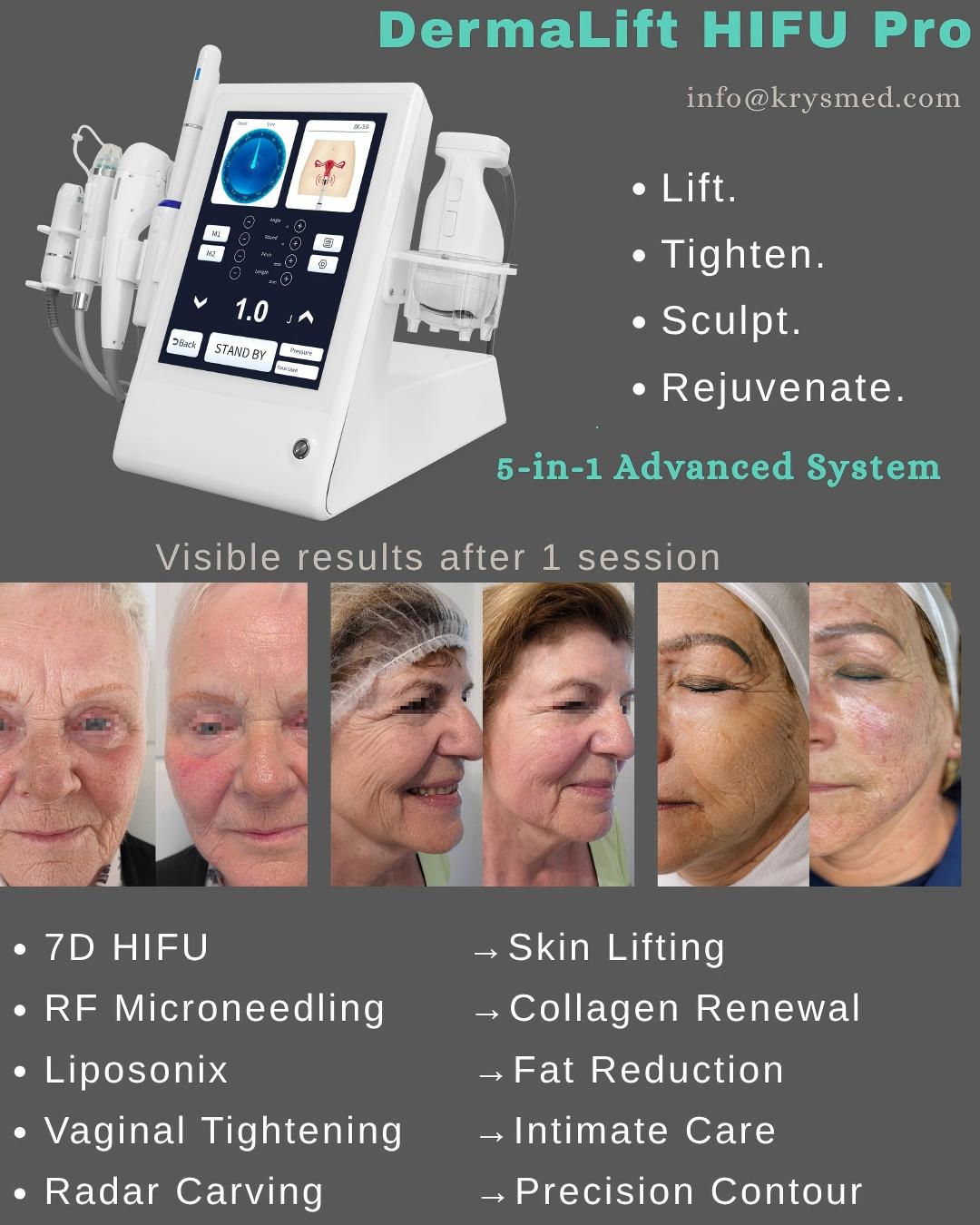 DermaLift HIFU Pro (1)