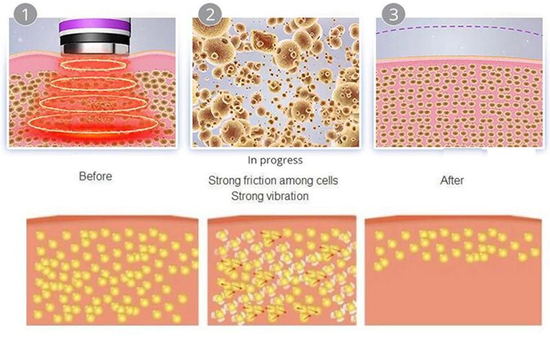 ultrasonic cavitation working principle 1