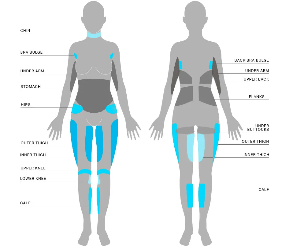 fat freezing treatment areas