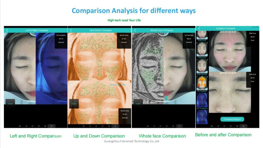 What Does a Skin Analysis Machine Do?
