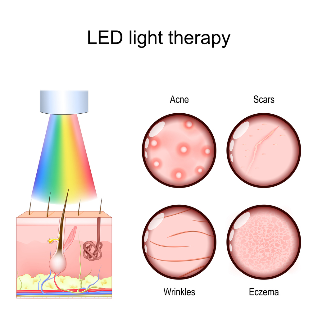 Clinical Benefits of LED Light Therapy