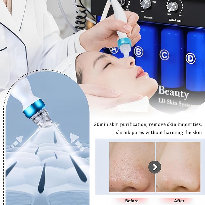 What Is HydraFacial?