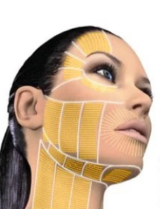 Full Face & Neck HIFU treatemnt mapping
