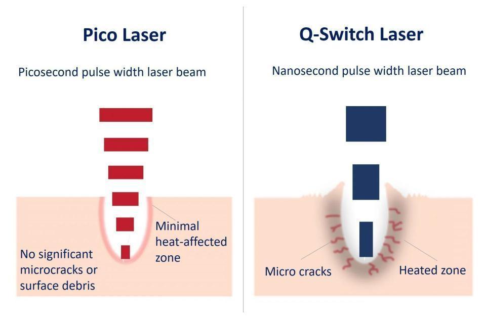 pico laser vs q-swiched laser