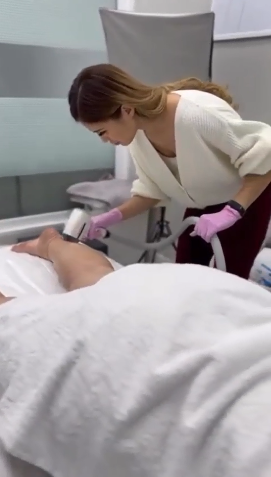KrySmooth AI Diode Laser treatment 