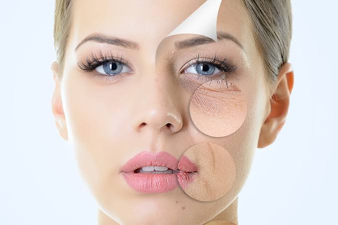 Wrinkle Reduction1 Wrinkle Reduction1