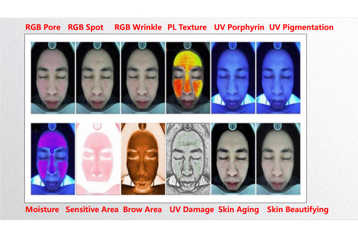 AI-Assisted Analysis Across 18 Skin Indicators AI-Assisted Analysis Across 18 Skin Indicators